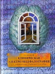 Клиническая электроэнцефалография с элементами эпилептологии, Руководство для врачей, Зенков Л.Р., 2004